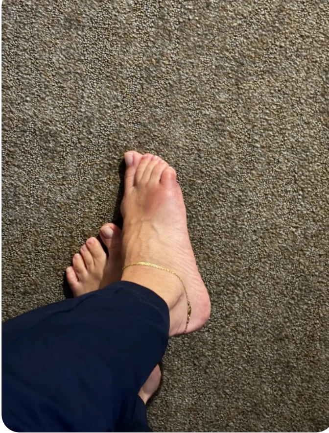 Click to hear a stomp! The evidence - actual foot
